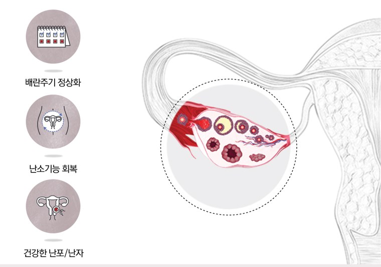 배란주기 정상화·난소기능 회복·건강한 난포/난자를 나타낸 아이콘과 성숙한 난포가 자라는 난소 해부 다이어그램