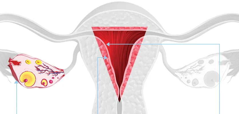자궁과 난소 경혈 부위 다이어그램 — 전기자극요법