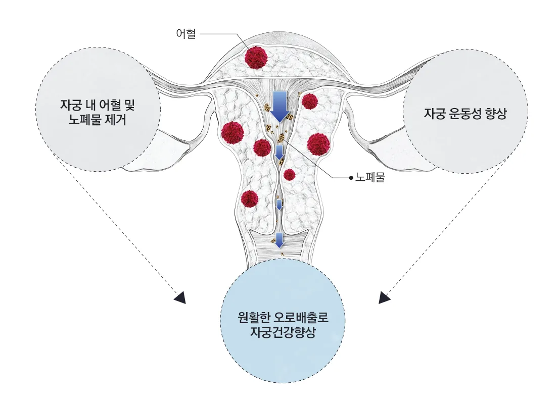 자궁 내 어혈 및 노폐물 제거 · 자궁 운동성 향상 → 원활한 오로배출로 자궁건강향상