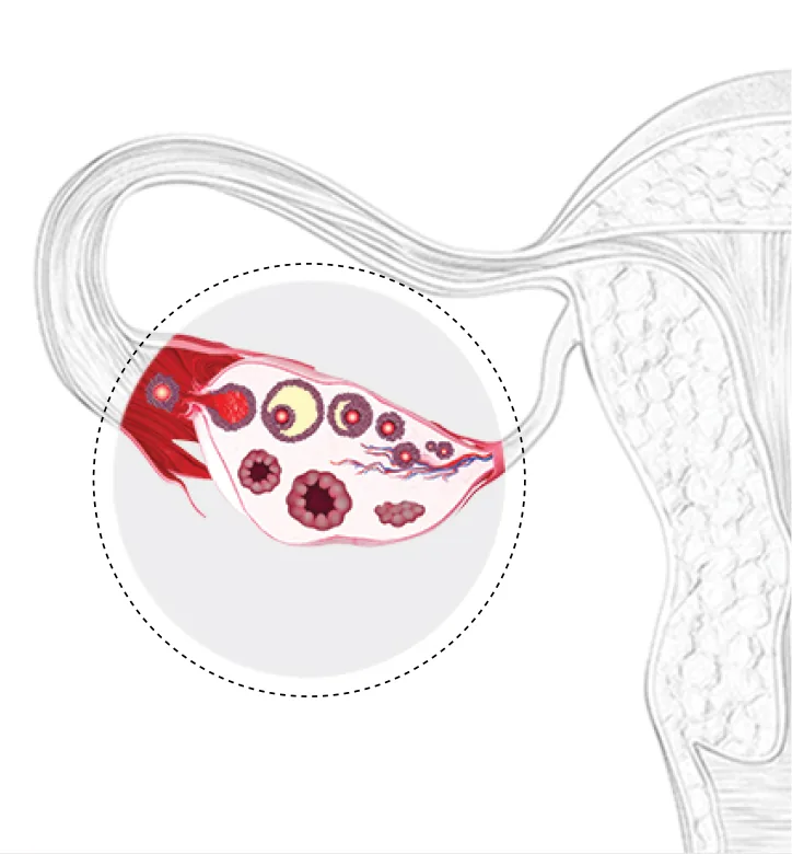 난소기능회복 — 배란주기 정상화, 난소기능 회복, 건강한 난포·난자